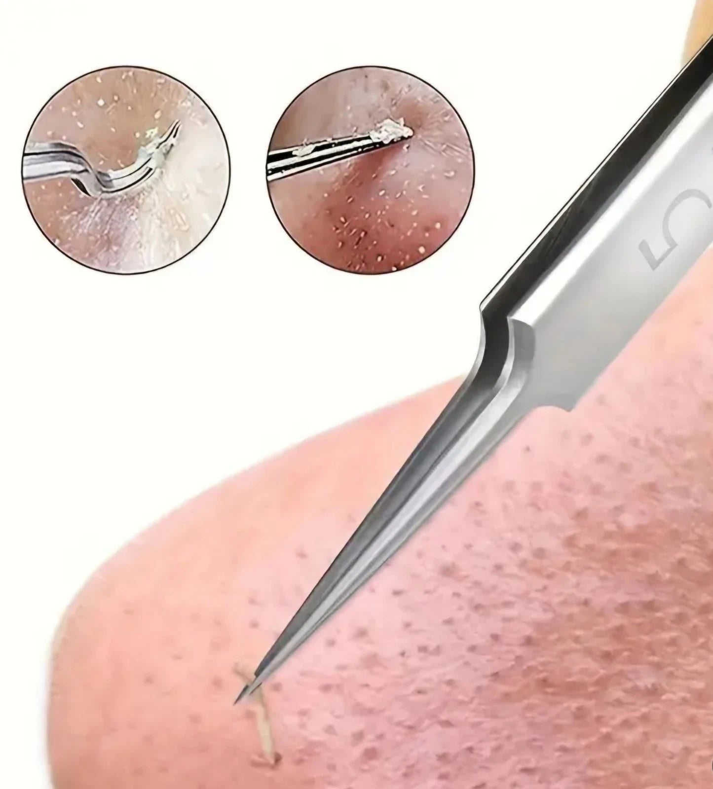 1 Pack Extra Fine No. 5 Blackhead Tweezers – Precision Acne Removal Tool for Facial Skin Care