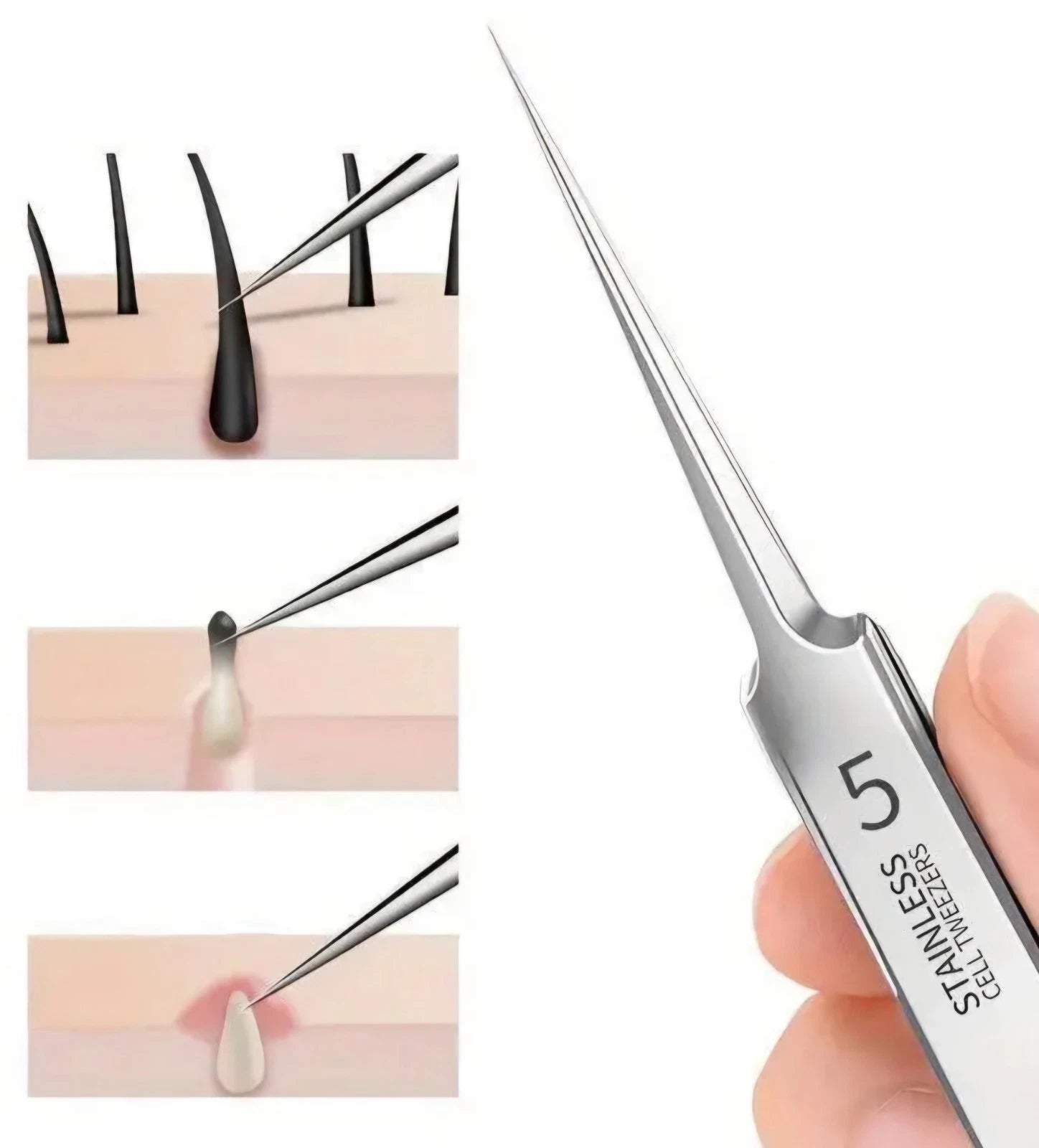 1 Pack Extra Fine No. 5 Blackhead Tweezers – Precision Acne Removal Tool for Facial Skin Care