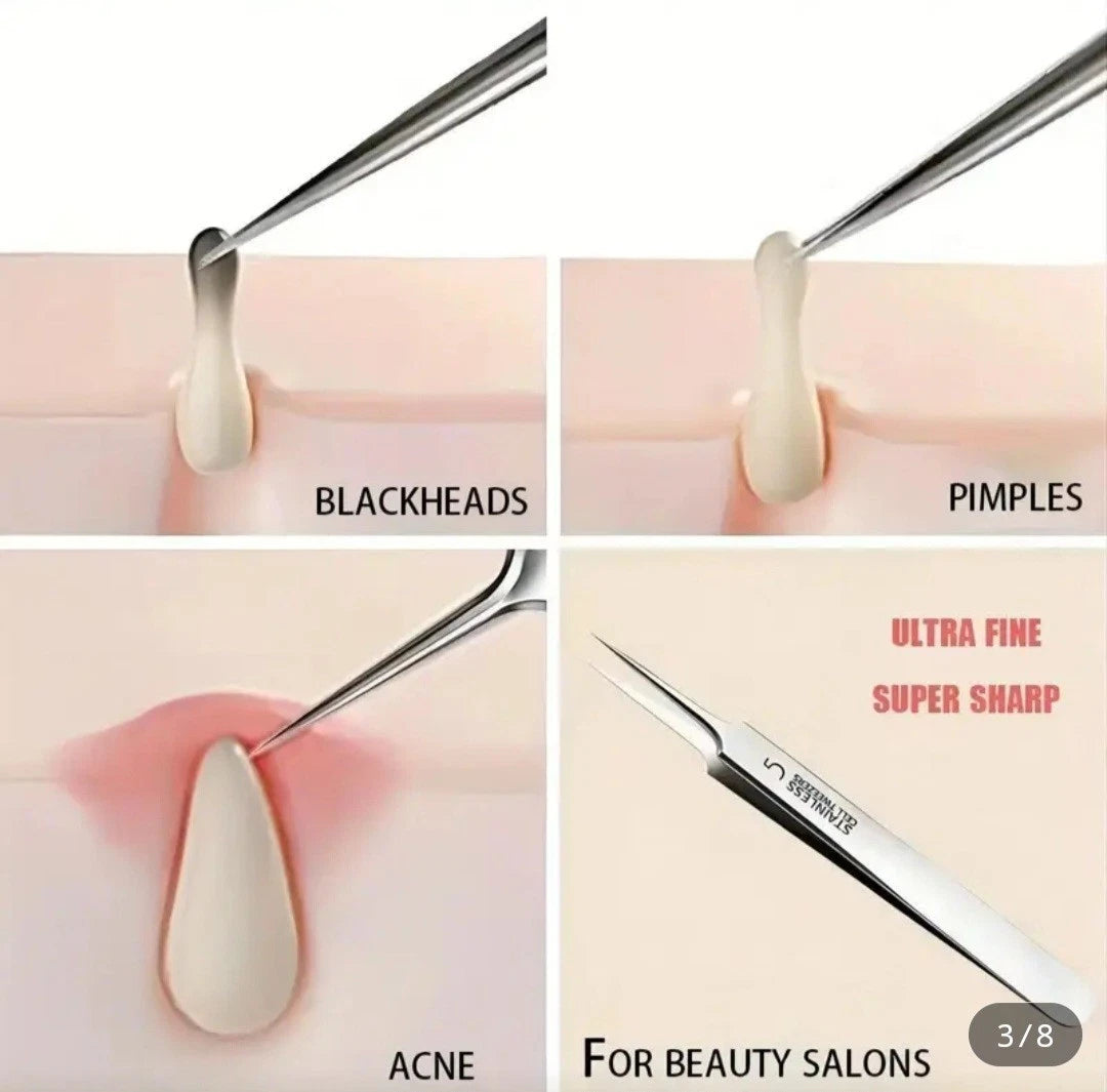 1 Pack Extra Fine No. 5 Blackhead Tweezers – Precision Acne Removal Tool for Facial Skin Care